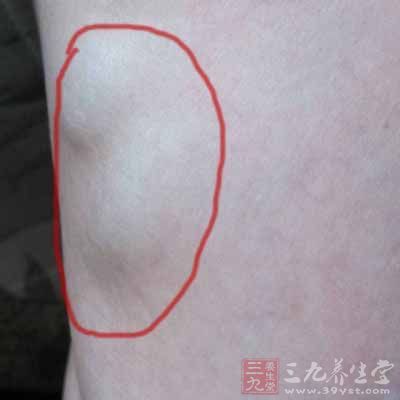 在身上摸到这个 竟是癌症前兆 - 妮子 - 妮 在身上摸到这个 竟是癌症前兆 - 妮子 - 妮